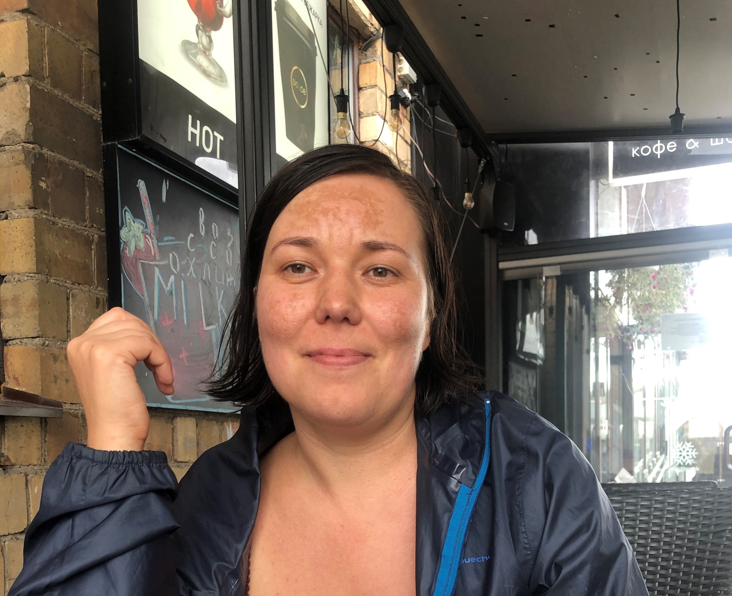 Katya (Ekaterina) Novikova mehrere Stunden nach ihrer Entlassung aus dem Gewahrsam. Minsk, 12. August 2020.