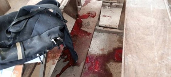 Blood stains on a floor