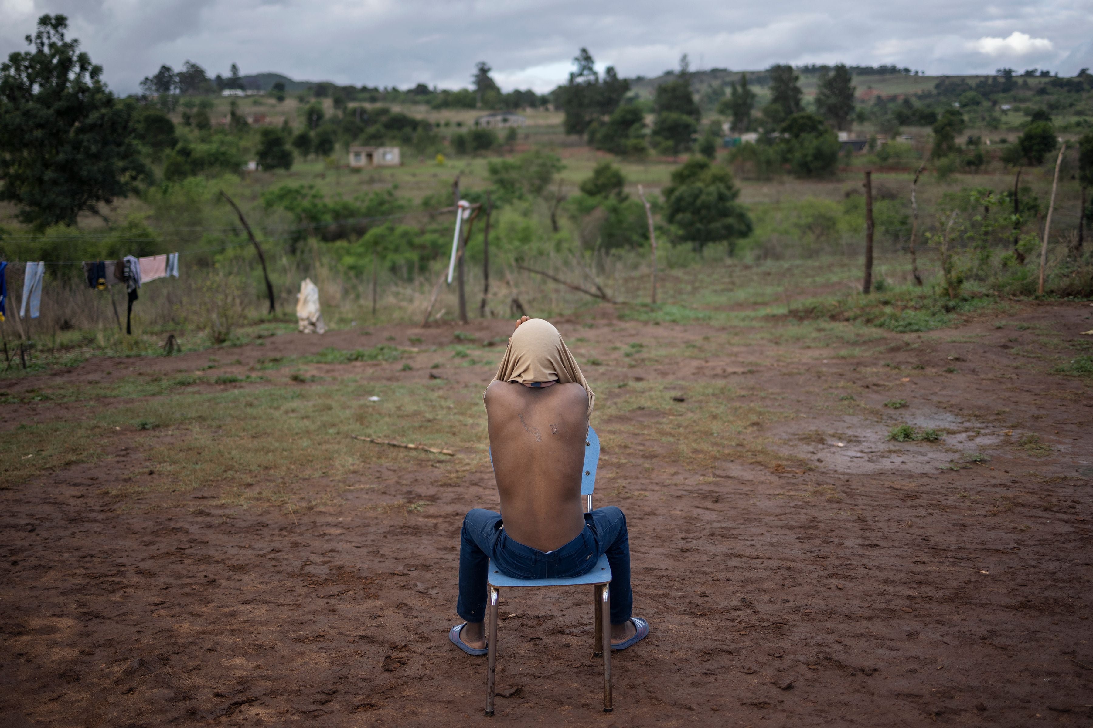 Un adolescent ayant participé à des manifestations pro-démocratie tenues en juin 2021 en Eswatini, pays situé dans le sud-est de l’Afrique, montrait son dos dans cette photo prise le 28 octobre 2021 dans la banlieue de Manzini. 