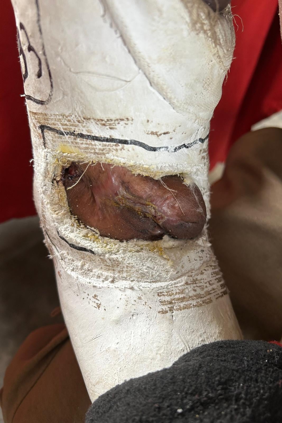 A man shows wounds to his elbow