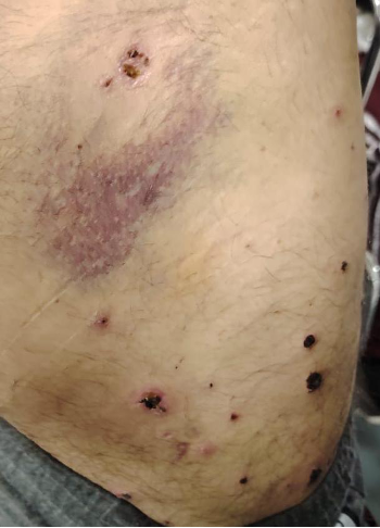 photo of injuries