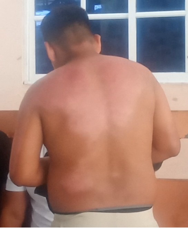 photo an injured back