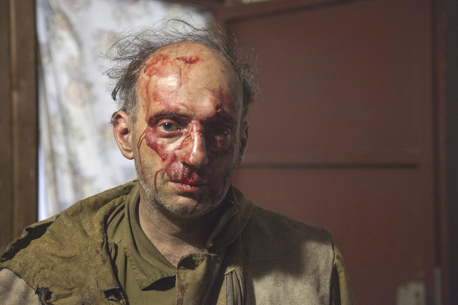 Michael Kreindlin, a Greenpeace member, after being beaten by attackers in Krasnodar region, Russia, September 8, 2016.