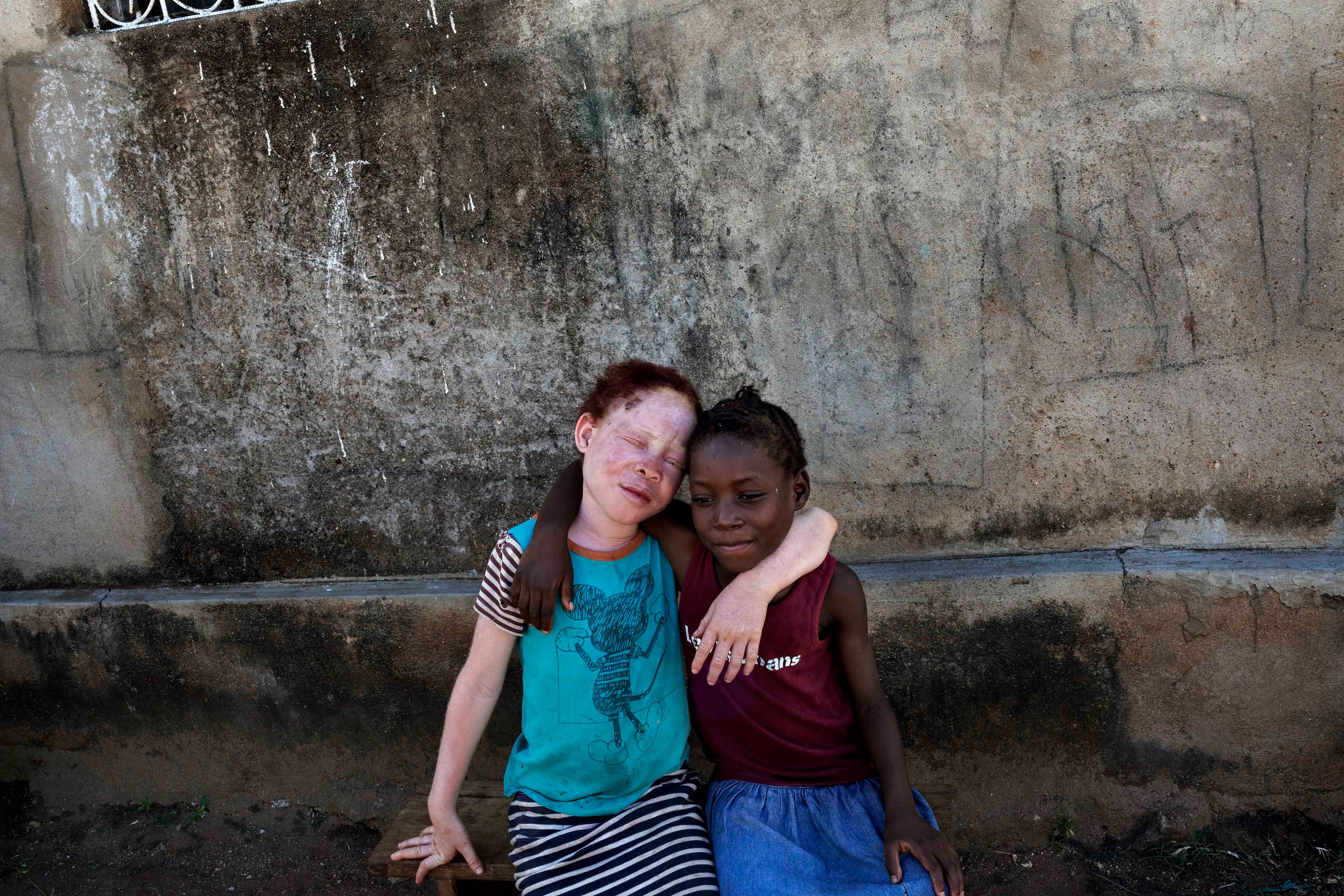 Josina (esquerda) com sua sobrinha Luisa, ambas com oito anos na época. "Ela é minha melhor amiga", disse Josina. "Ela está sempre perguntando se eu estou bem, ela me ajuda a ler depois da escola e cuida de mim”.