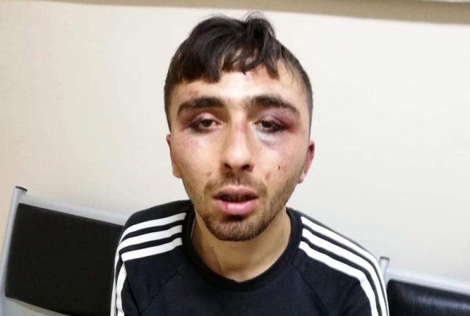B. Y., Aralık ayında polisin onu gözaltına aldığını ve bir polis karakoluna götürürken dövdüğünü iddia ediyor. 