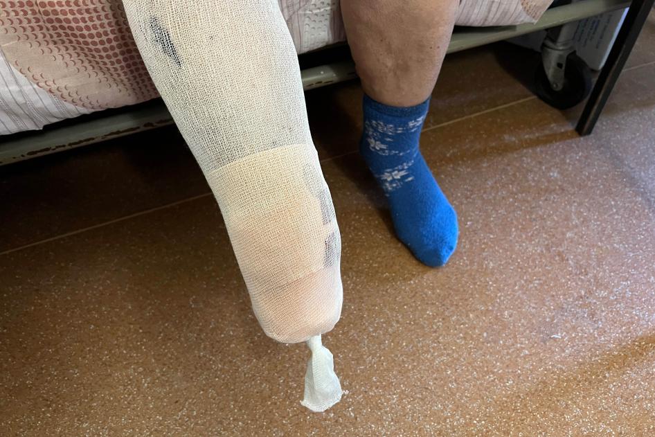 Resident sits on a bed. Picture taken of amputated lower leg. 