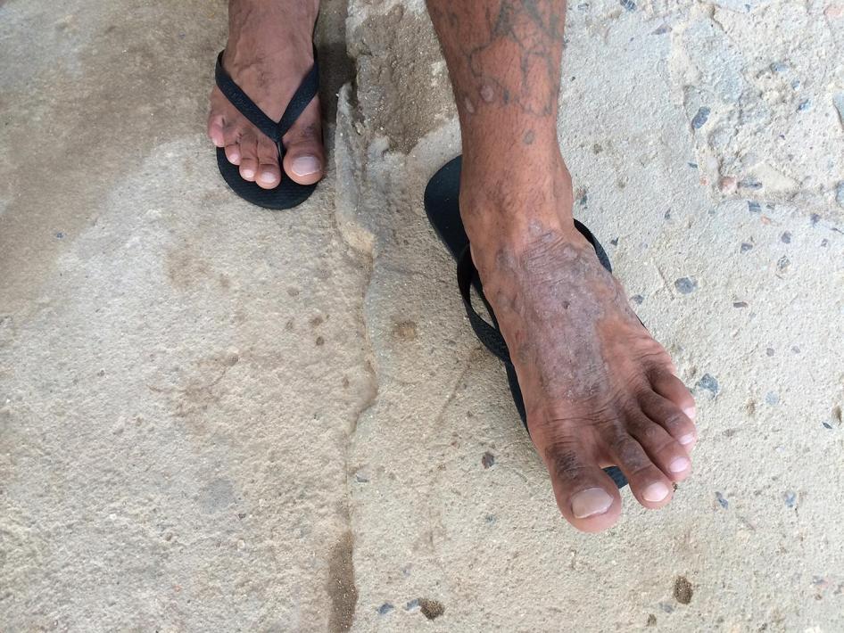 detainee at Penitenciária Agro-Industrial São João (PAISJ)