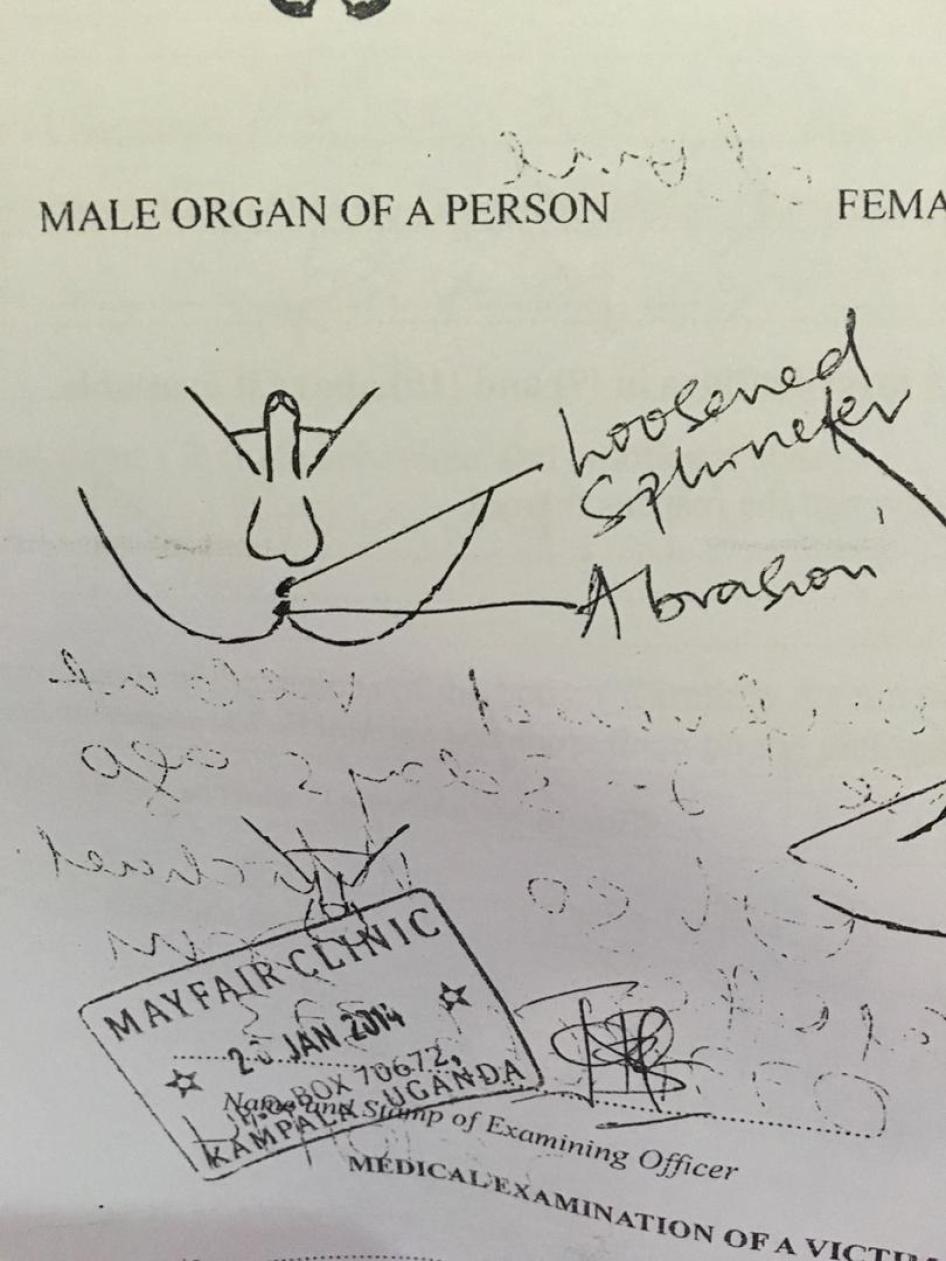 anal exam from Uganda 