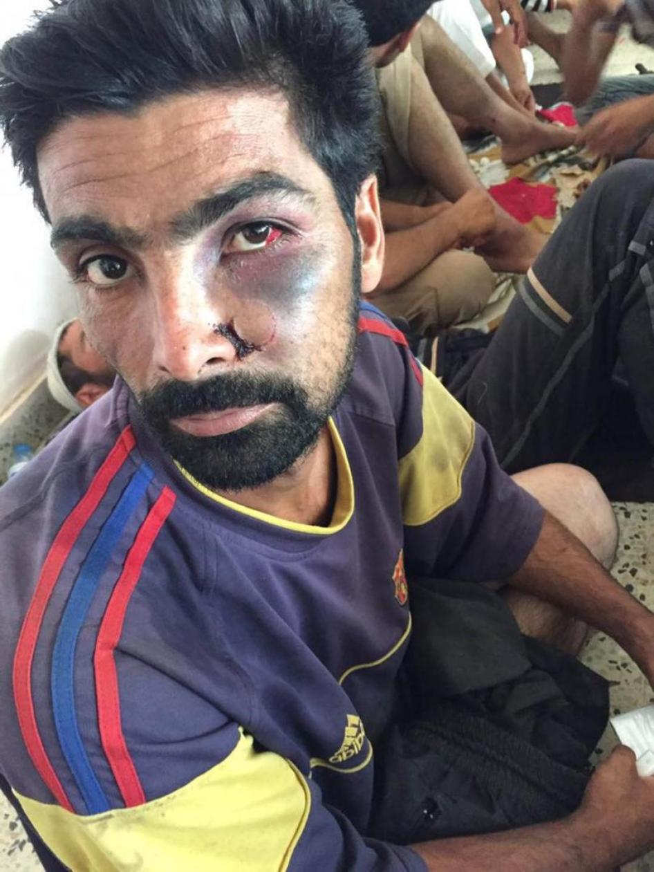 واحد من بين أكثر من 600 رجل وصبي تلقوا العلاج في مستشفى عامرية الفلوجة، كانوا قد تعرضوا لانتهاكات على يد "قوات الحشد الشعبي" العراقية في الصقلاوية بعد أخذ هذه القرية من داعش، بحسب شهادة أشخاص قابلوا العديد منهم.