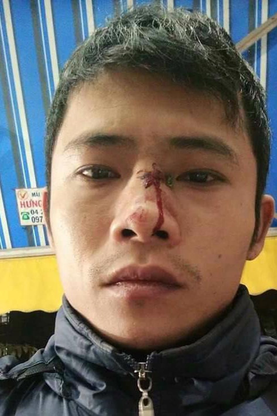 Đinh Hồng Quyền sau khi bị hành hung ở Hà Đông ngày mồng 2 tháng Mười hai năm 2016.
