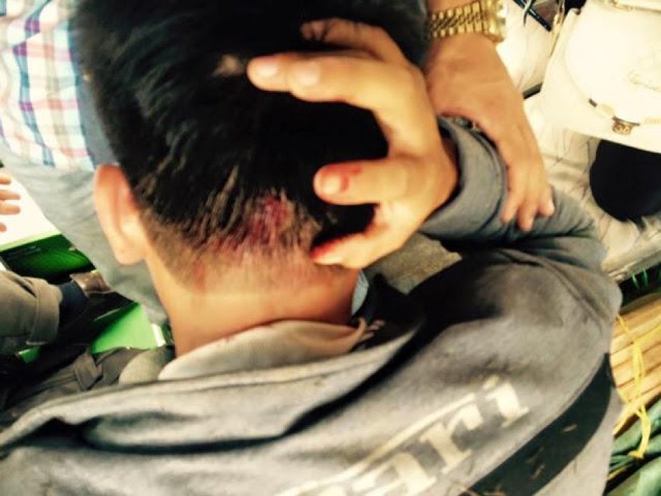 Chu Mạnh Sơn sau khi bị hành hung ở Lâm Đồng ngày 28 tháng Tám năm 2015.