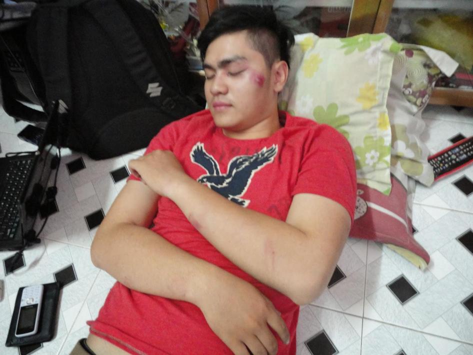 Nguyễn Quang Triệu sau khi bị hành hung ở Bình Dương ngày 25 tháng Ba năm 2015.