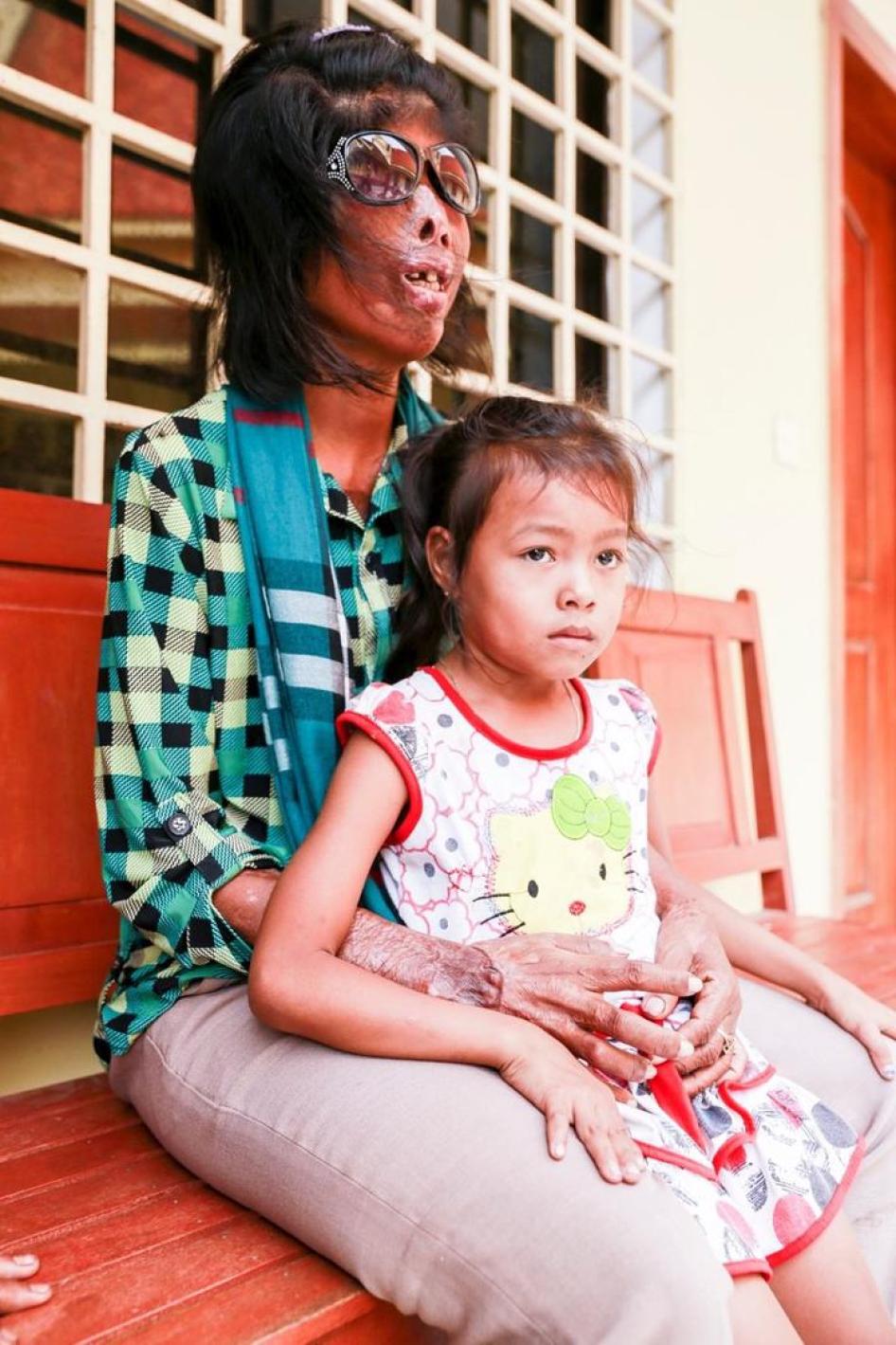 គង់​ ទូច កំពុង​រង់​ចាំ​​សាល​ក្រម​ នៅ​ខាង​ក្រៅ​តុលាការ​កំពូល​កម្ពុជា​ នៅ​ថ្ងៃ​ទី​២២​ ខែ​កក្កដា​ ឆ្នាំ​២០១៥។