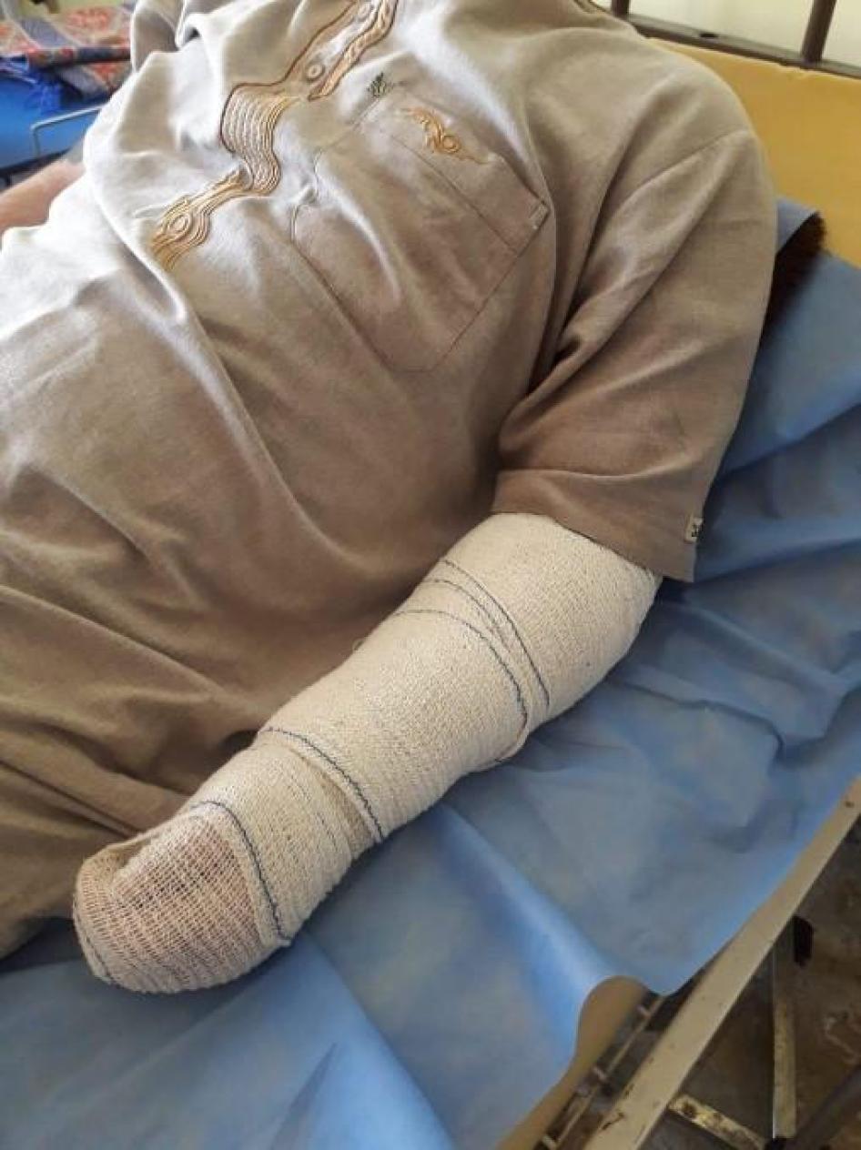 تسبب عنصر شرطة بجراح خطيرة في الذراع اليسرى للمحتجز بينما كان يعذبه خلال استجوابه، ما أدى في نهاية المطاف إلى بتر الذراع بعد عمليات جراحية غير ناجحة. ©2018 خاص