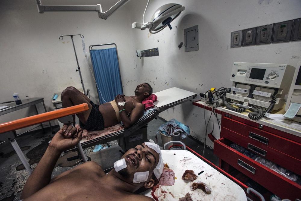 Two ER patients, one with head trauma from a car accident, and another who had been stabbed, in the emergency operating room of the University Hospital Dr. Luis Razetti in Barcelona, April 16, 2016. 