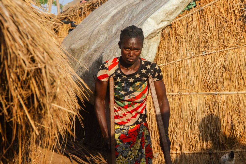 “Blandine,” a 30-year-old woman with a physical disability caused by polio, in a displacement camp in Bambari. She played dead during a UPC attack on the town of Yassine in March 2017 because she could not run away.